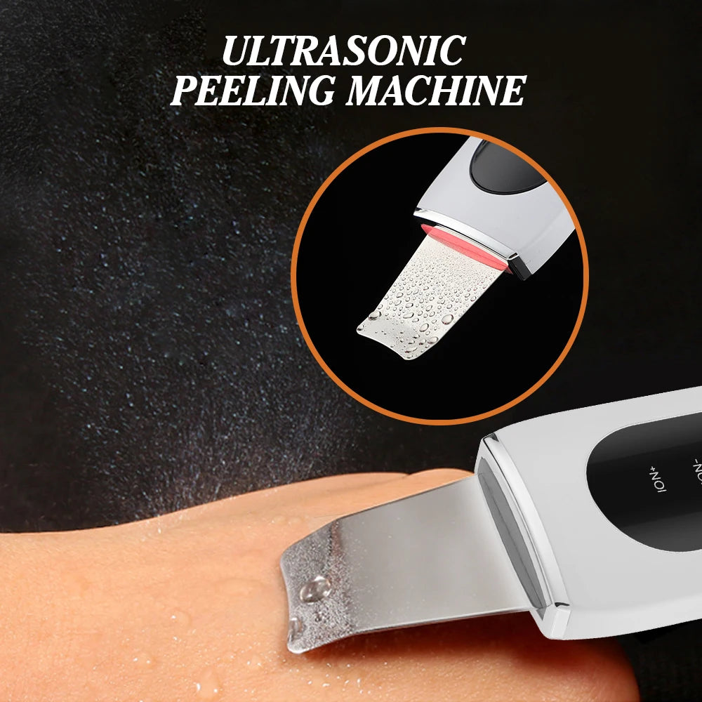 Ultrasonic Face Skin Scrubber Vibration Nose Deep Cleaning Machine Facial Spatula Blackhead Remover Peeling Shovel Pore Clean