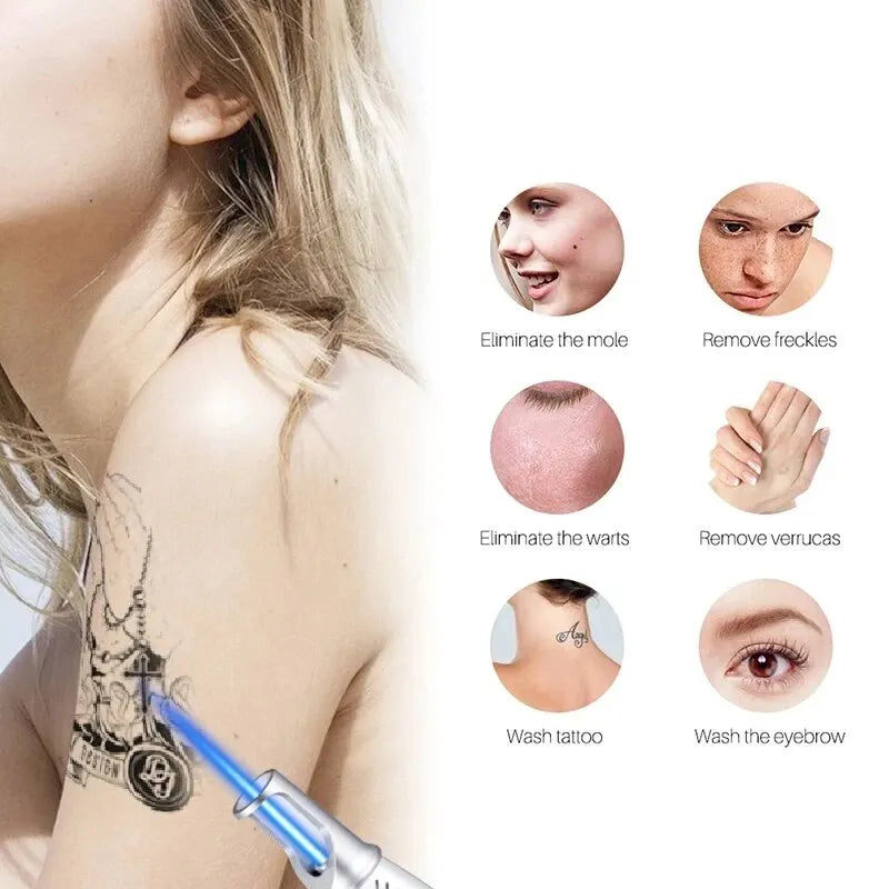 Picosecond Laser Pointer for Mole Removal Dark Spot Removal Pen Tattoo Acne Skin Pigment Portable Removal Machine Beauty Device