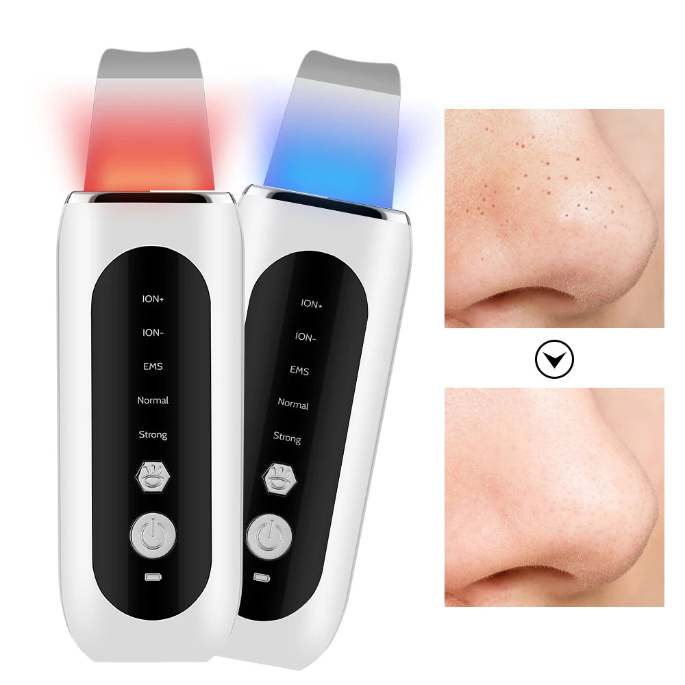 Ultrasonic Face Skin Scrubber Vibration Nose Deep Cleaning Machine Facial Spatula Blackhead Remover Peeling Shovel Pore Clean