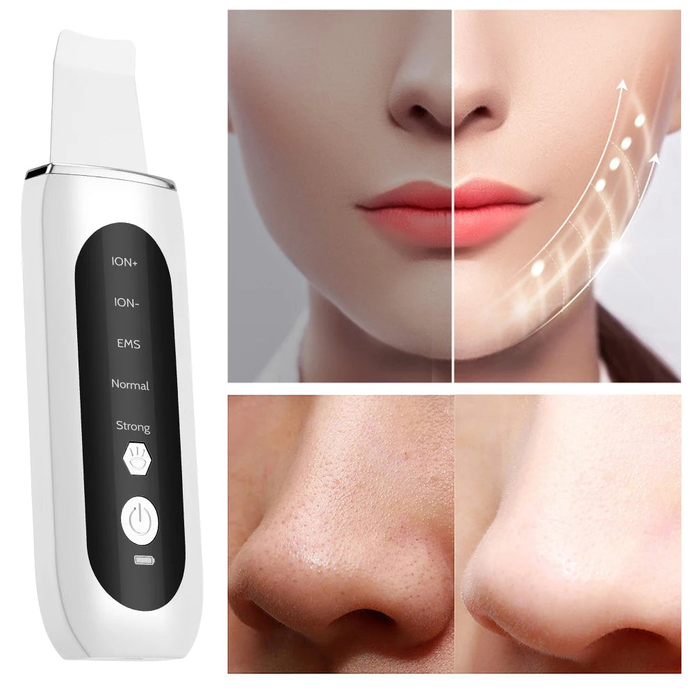 Ultrasonic Face Skin Scrubber Vibration Nose Deep Cleaning Machine Facial Spatula Blackhead Remover Peeling Shovel Pore Clean