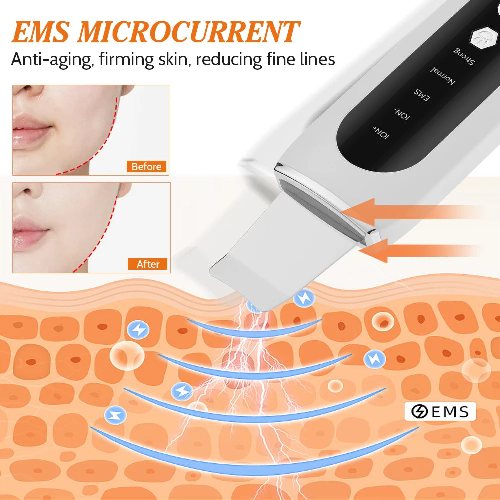 Ultrasonic Face Skin Scrubber Vibration Nose Deep Cleaning Machine Facial Spatula Blackhead Remover Peeling Shovel Pore Clean