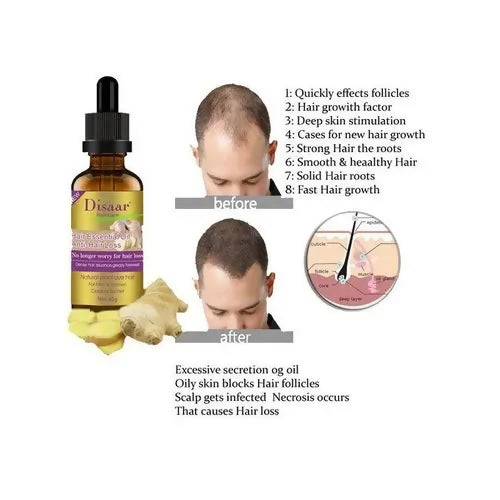 Disaar Hair Growth In Baldness Essential Oil -Anti Hair Loss -30ml