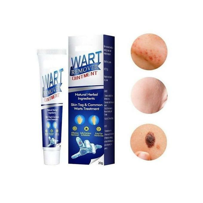 Warts Remover Ointment Warts Remover