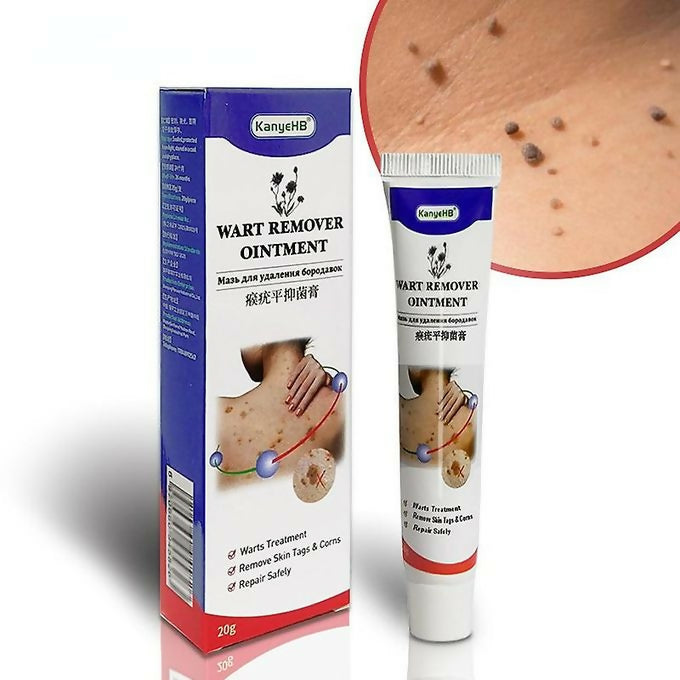 Warts Remover Ointment Warts Remover