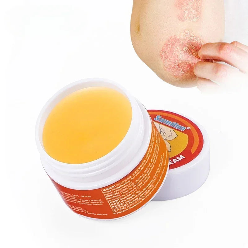 Medical Psoriasis Cream Dermatitis Eczematoid Ointment Antibacterial A ...