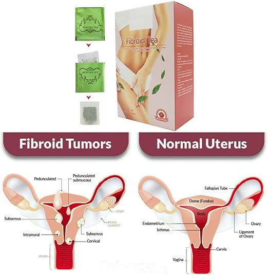Fibroid Herbal Tea