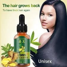 King Of Ginger 7 Days Hair Growth Oil 30ml