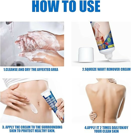 Warts Remover Ointment Warts Remover